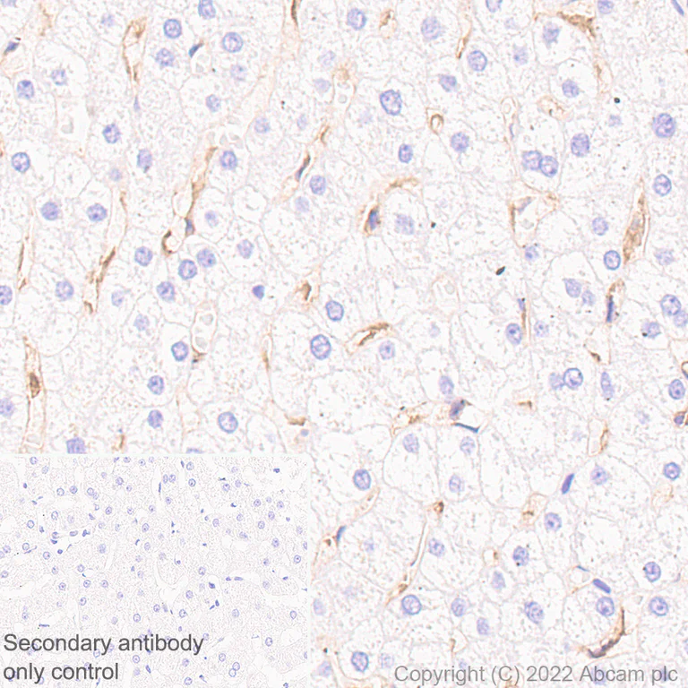 Immunohistochemistry (Formalin/PFA-fixed paraffin-embedded sections) - Anti-HLA E antibody [EPR25300-104] (BSA and Azide free) (AB300554)