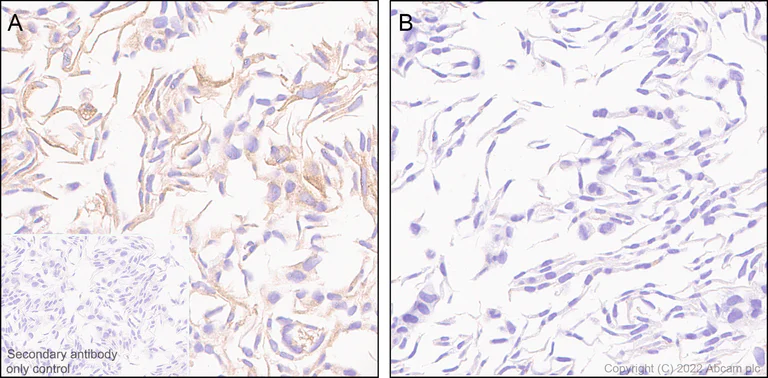 Immunohistochemistry (Formalin/PFA-fixed paraffin-embedded sections) - Anti-HLA E antibody [EPR25300-104] (BSA and Azide free) (AB300554)