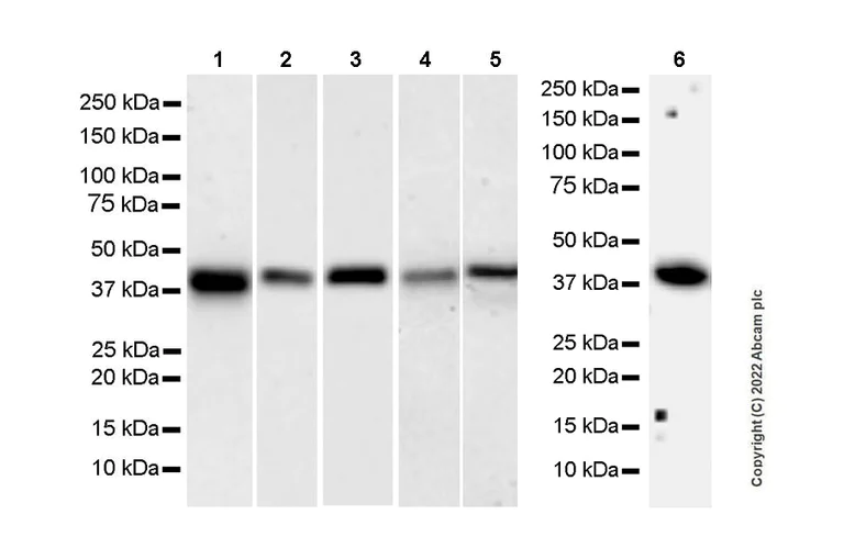 Western blot - Anti-HLA E antibody [EPR25300-104] (BSA and Azide free) (AB300554)