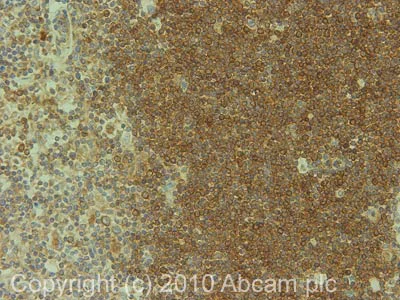 Immunohistochemistry (Formalin/PFA-fixed paraffin-embedded sections) - Anti-HLA E antibody [MEM-E/02] (AB2216)