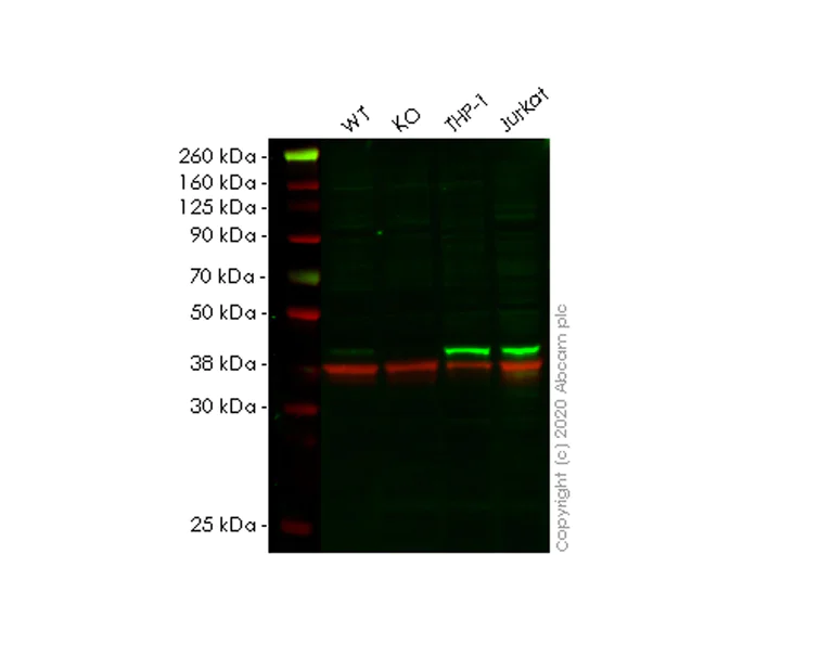 Western blot - Anti-HLA E antibody [MEM-E/02] (AB2216)