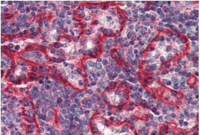 Immunohistochemistry (Formalin/PFA-fixed paraffin-embedded sections) - Anti-HLA E antibody [MEM-E/07] (AB11820), expandable thumbnail