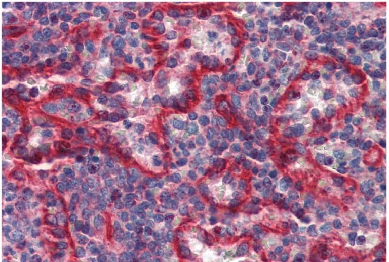 Immunohistochemistry (Formalin/PFA-fixed paraffin-embedded sections) - Anti-HLA E antibody [MEM-E/07] (AB11820)