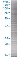 HLA E overexpression 293T lysate (whole cell)