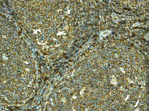 Immunohistochemistry (Formalin/PFA-fixed paraffin-embedded sections) - Anti-HLA F antibody [EPR6803] - BSA and Azide free (AB248133)