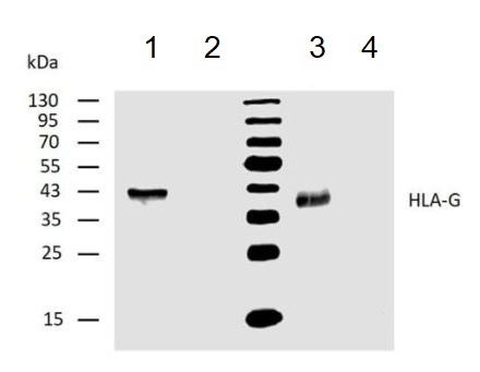 Western blot - Anti-HLA G antibody [4H84] (AB52455), expandable thumbnail