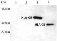 Western blot - Anti-HLA G antibody [5A6G7] (AB76869)