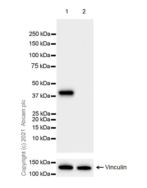 Western blot - Anti-HLA G antibody [EPR23298-97] (AB283260)