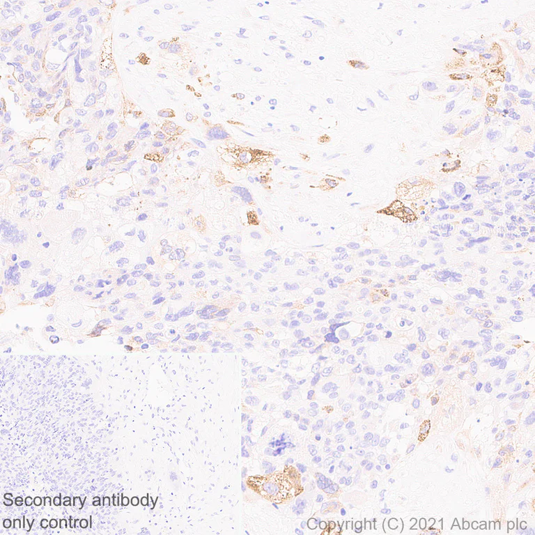 Immunohistochemistry (Formalin/PFA-fixed paraffin-embedded sections) - Anti-HLA G antibody [EPR23298-97] - BSA and Azide free (AB283278)