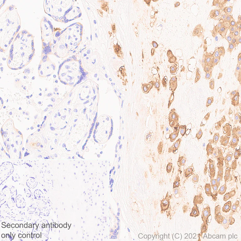Immunohistochemistry (Formalin/PFA-fixed paraffin-embedded sections) - Anti-HLA G antibody [EPR23298-97] - BSA and Azide free (AB283278)