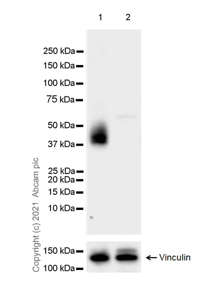 Western blot - Anti-HLA G antibody [EPR23298-97] - BSA and Azide free (AB283278)