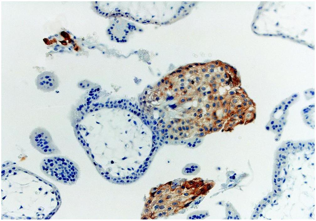 Immunohistochemistry (Formalin/PFA-fixed paraffin-embedded sections) - Anti-HLA G antibody [MEM-G/1] (AB7759)