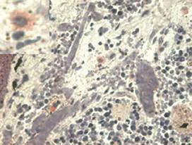 Immunohistochemistry (Formalin/PFA-fixed paraffin-embedded sections) - Anti-HLA G antibody [MEM-G/1] (AB7759)