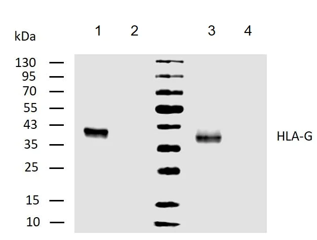 Western blot - Anti-HLA G antibody [MEM-G/1] (AB7759)