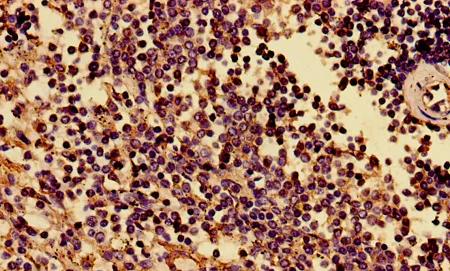 Immunohistochemistry (Formalin/PFA-fixed paraffin-embedded sections) - Anti-HLAB antibody (AB193415)