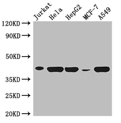 Western blot - Anti-HLAB antibody (AB193415)