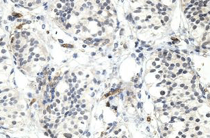 Immunohistochemistry (Formalin/PFA-fixed paraffin-embedded sections) - Anti-HLAB antibody (AB197166)