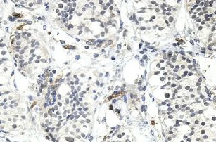 Immunohistochemistry (Formalin/PFA-fixed paraffin-embedded sections) - Anti-HLAB antibody (AB197166)