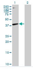 Western blot - Anti-HLAB antibody (AB76795), expandable thumbnail