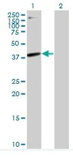 Western blot - Anti-HLAB antibody (AB76795)