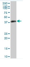 Western blot - Anti-HLAB antibody (AB76795), expandable thumbnail