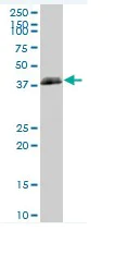 Western blot - Anti-HLAB antibody (AB76795)