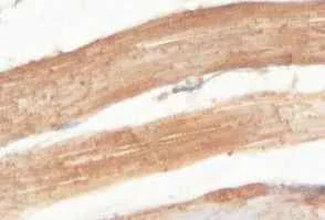 Immunohistochemistry (Formalin/PFA-fixed paraffin-embedded sections) - Anti-HLCS antibody (AB100925)