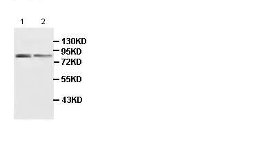 Western blot - Anti-HLCS antibody (AB100925)