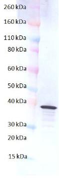 Western blot - Anti-hlgB antibody (AB190338), expandable thumbnail