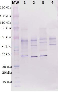 Western blot - Anti-hlgB antibody (AB190338), expandable thumbnail