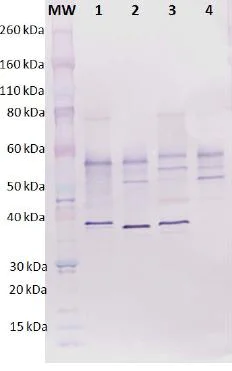 Western blot - Anti-hlgB antibody (AB190338)