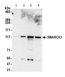 Western blot - Anti-HLTF antibody (AB17984)