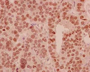 Immunohistochemistry (Formalin/PFA-fixed paraffin-embedded sections) - Anti-HLTF antibody [EPR14761] (AB183042)