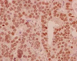 Immunohistochemistry (Formalin/PFA-fixed paraffin-embedded sections) - Anti-HLTF antibody [EPR14761] - BSA and Azide free (AB250652)