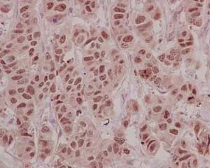 Immunohistochemistry (Formalin/PFA-fixed paraffin-embedded sections) - Anti-HLTF antibody [EPR14761] - BSA and Azide free (AB250652)