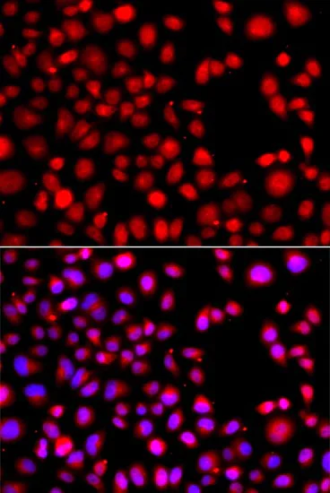 Immunocytochemistry/ Immunofluorescence - Anti-HLX1 antibody (AB210808)