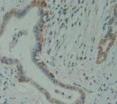 Immunohistochemistry (Formalin/PFA-fixed paraffin-embedded sections) - Anti-HMBS/PBGD antibody (AB232927)