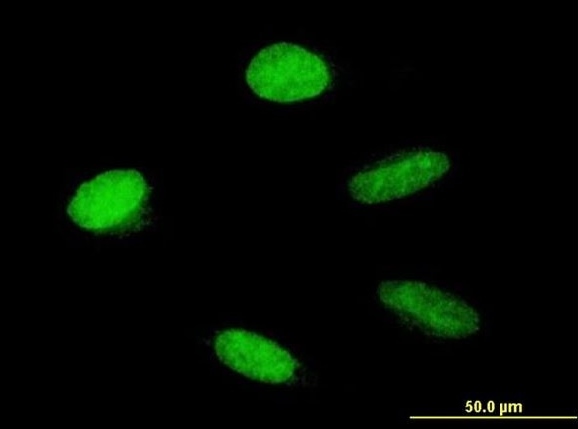 Immunocytochemistry/ Immunofluorescence - Anti-HMGA1 antibody (AB168260)