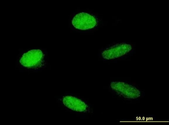 Immunocytochemistry/ Immunofluorescence - Anti-HMGA1 antibody (AB168260)