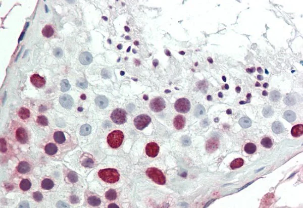 Immunohistochemistry (Formalin/PFA-fixed paraffin-embedded sections) - Anti-HMGA1 antibody (AB230384)