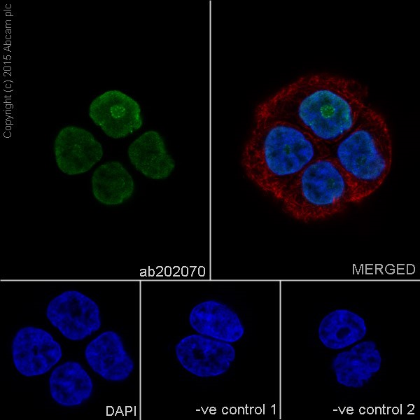 Immunocytochemistry/ Immunofluorescence - Anti-HMGA1 antibody [EPR16649] (AB202070), expandable thumbnail