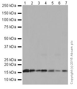 Western blot - Anti-HMGA1 antibody [EPR16649] (AB202070), expandable thumbnail