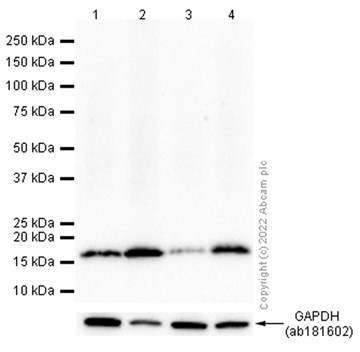 Western blot - Anti-HMGA1 antibody [EPR16649] (AB202070), expandable thumbnail