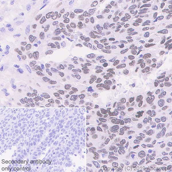 Immunohistochemistry (Formalin/PFA-fixed paraffin-embedded sections) - Anti-HMGA1 antibody [EPR22421-101] - BSA and Azide free (ab255277), expandable thumbnail