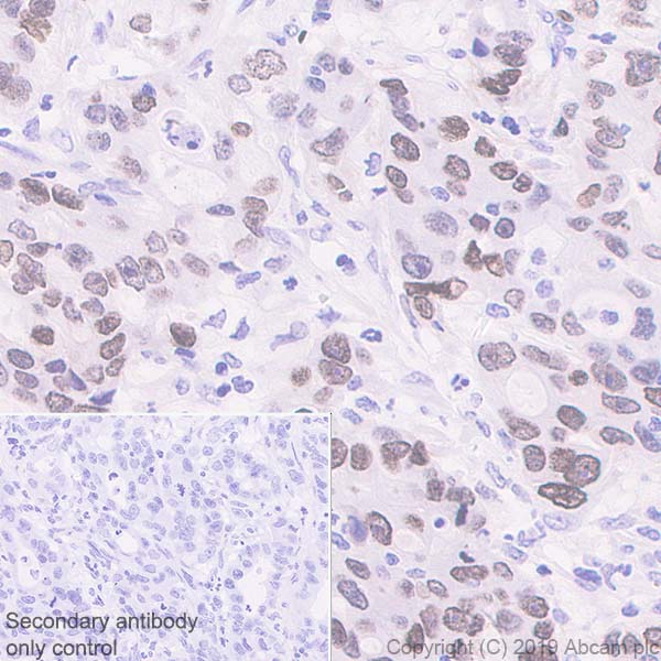 Immunohistochemistry (Formalin/PFA-fixed paraffin-embedded sections) - Anti-HMGA1 antibody [EPR22421-101] - BSA and Azide free (ab255277), expandable thumbnail