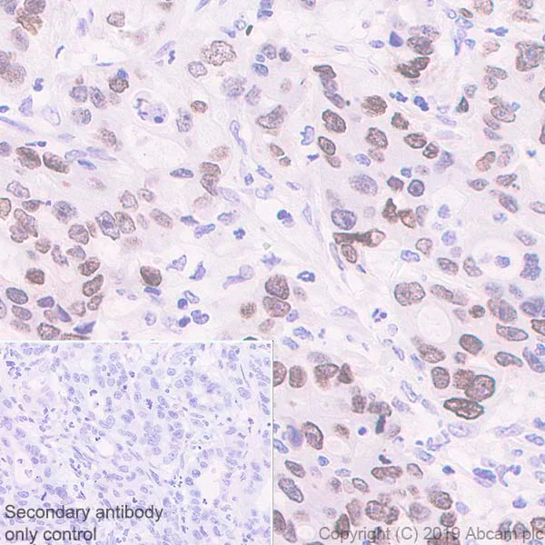 Immunohistochemistry (Formalin/PFA-fixed paraffin-embedded sections) - Anti-HMGA1 antibody [EPR22421-101] - BSA and Azide free (AB255277)