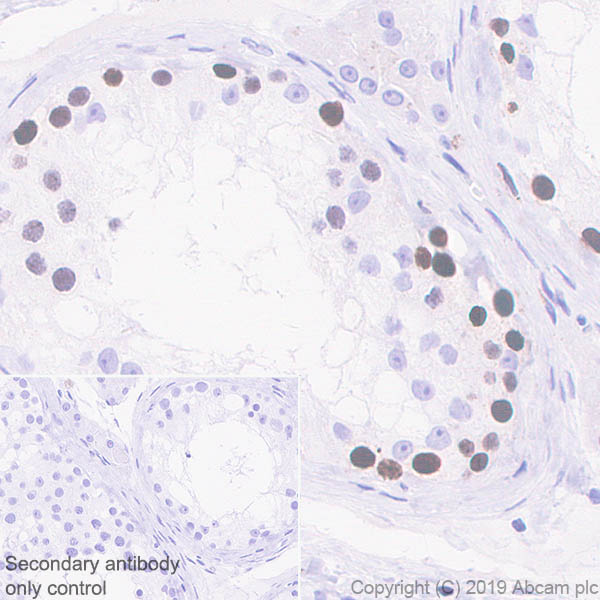 Immunohistochemistry (Formalin/PFA-fixed paraffin-embedded sections) - Anti-HMGA1 antibody [EPR22421-101] - ChIP Grade (AB252930)