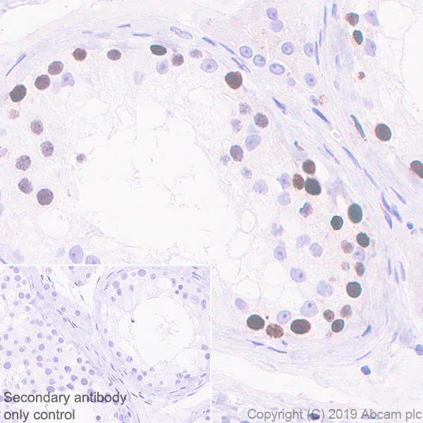 Immunohistochemistry (Formalin/PFA-fixed paraffin-embedded sections) - Anti-HMGA1 antibody [EPR22421-101] - ChIP Grade (AB252930)
