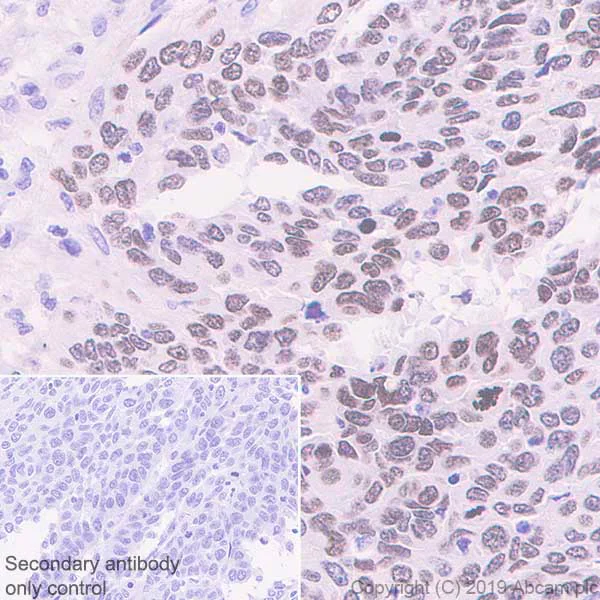 Immunohistochemistry (Formalin/PFA-fixed paraffin-embedded sections) - Anti-HMGA1 antibody [EPR22421-101] - ChIP Grade (AB252930)