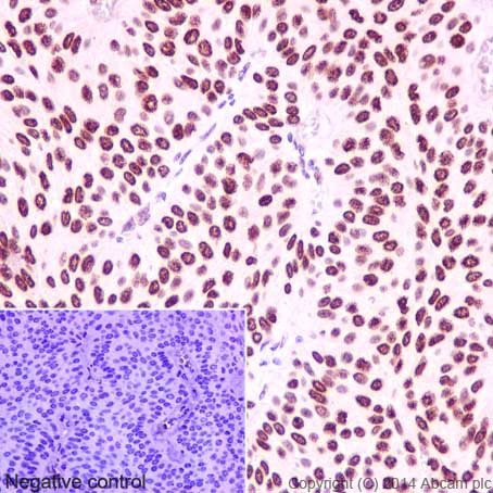 Immunohistochemistry (Formalin/PFA-fixed paraffin-embedded sections) - Anti-HMGA1 antibody [EPR7839] (AB129153)